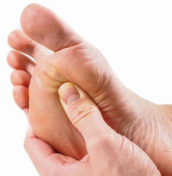 Neuroma-de-Morton